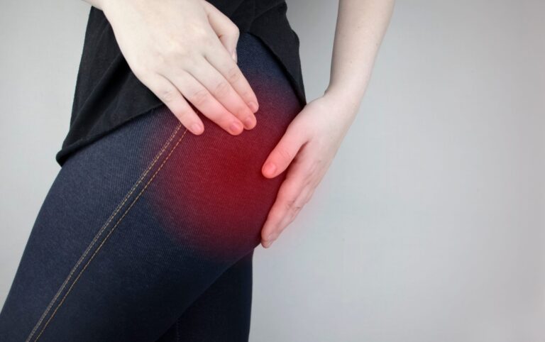 Piriformis syndrome: 5 ways to prevent and stay healthy